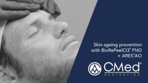 Skin ageing prevention with BioRePeelCI3® FND + ARES® AO