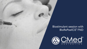 Biostimulant session with BioRePeelCI3® FND®