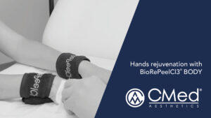 Hands rejuvenation with BioRePeelCI3® BODY