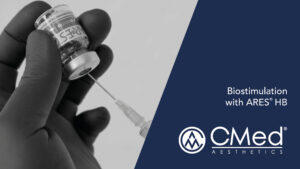 Biostimulation with ARES® HB