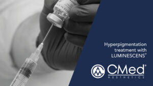 Hyperpigmentation treatment with LUMINESCENS®